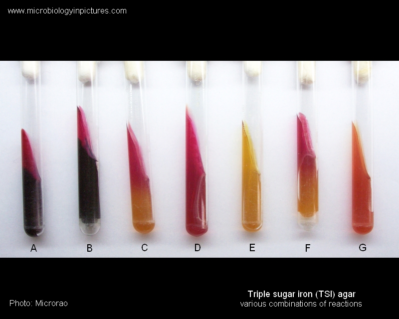 various bacteria on TSI result