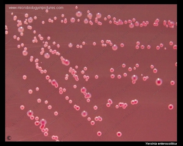 yersinia enterocolitica colonies on Endo