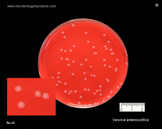 blood agar plate with Yersinia enterocolitica bacteria, pure culture of Y.enterocolitica on agar medium