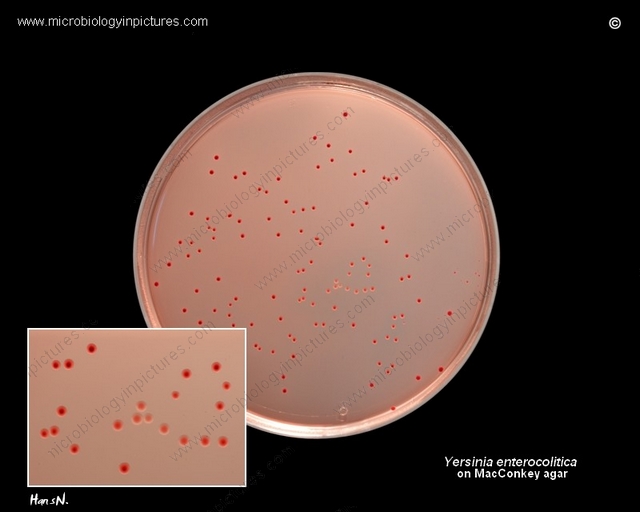 macconkey agar plate with Yersinia enterocolitica colonies, colony size
