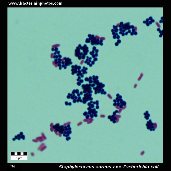 https://www.microbiologyinpictures.com/bacteriainphotos/bacteria%20under%20microscope/gram%20positive%20bacteria/staphylococcus%20aureus%20and%20ecoli.jpg