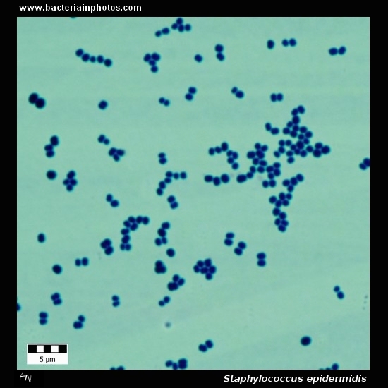 staphylococcus epidermidis gram stain