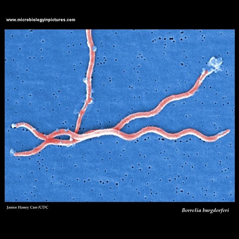 Borrelia burgdorferi electron microscopy, SEM