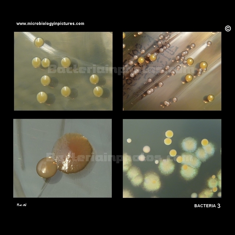bacteria photos