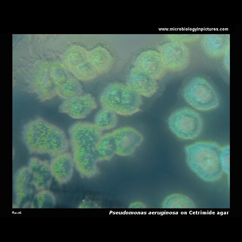 pseudomonas aeruginosa cetrimide agar
