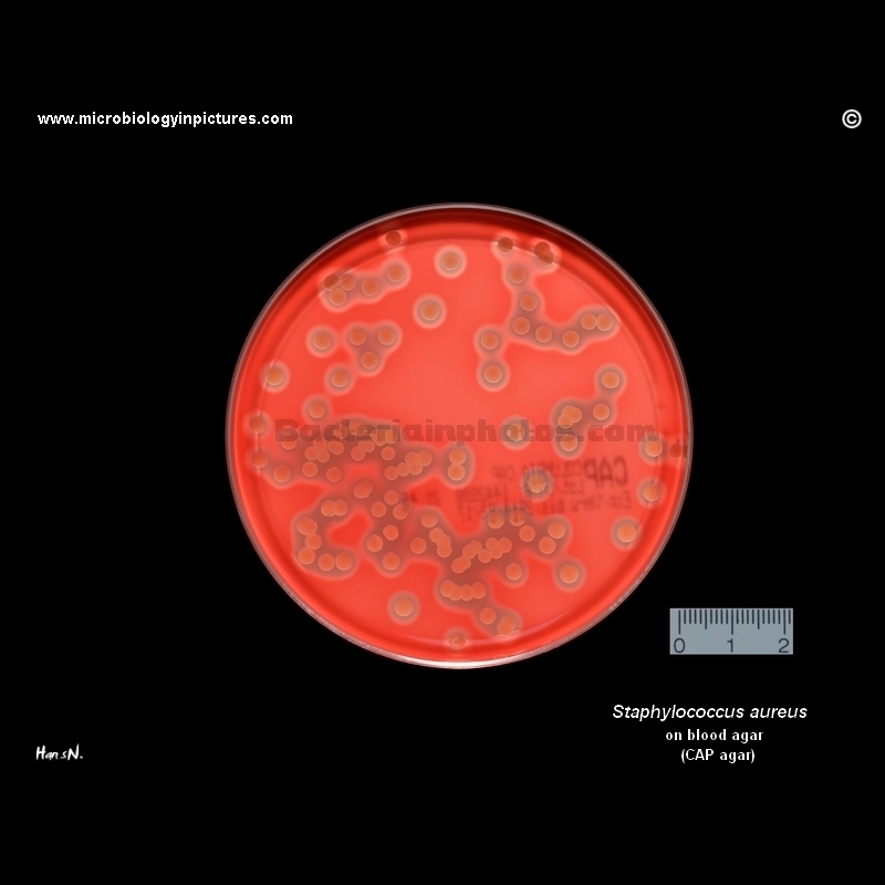 Staphylococcus aureus