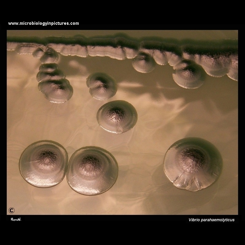 Vibrio parahaemolyticus colonies on TCBS agar