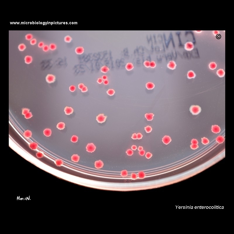 yersinia enterocolitica CIN