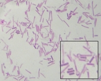 sporulating clostridium tetani Gram stain