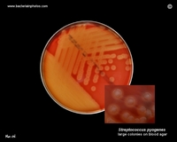 s.pyogenes large colonies on agar plate