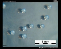 s.epidermidis colonies