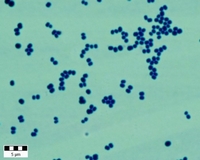 Staphylococcus epidermidis gram stain
