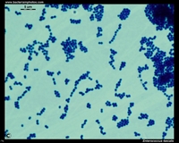 enterococcus faecalis Gram stain