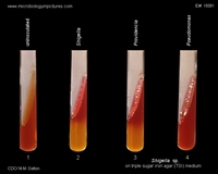 shigella, providencia, pseudomonas on TSI medium