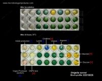 biochemical tests for identification of shigella