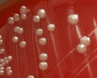 colonies of pasteurella multocida on blood agar
