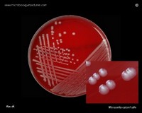 Moraxella catarrhalis on blood agar