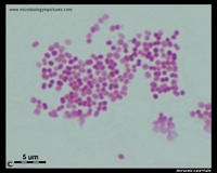 Gram stain of moraxella