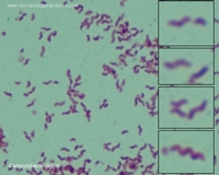 Campylobacter Gram stain
