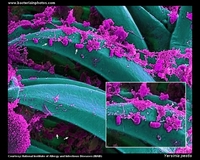 Yersinia pestis SEM image