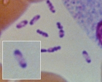 y.pestis Gram stain