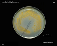 v.cholerae on TCBS agar
