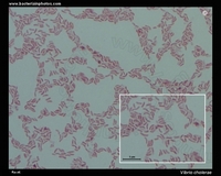 Gram-stained cells of vibrio cholerae