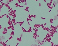 e.coli Gram stain