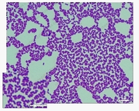 listeria Gram stain