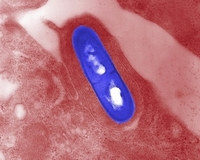 listeria monocytogenes TEM