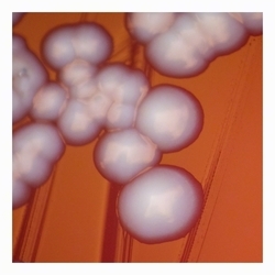Colonies of E.coli without hemolysis typical colony of E.coli without hemolysis