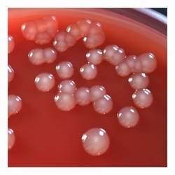 Pearly colonies (3–4 mm); hypermucoid strain hypermucoid strain of E.coli with strong surface adherence