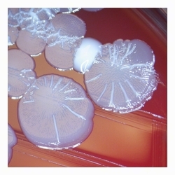 Heterogeneous colonies Heterogeneous colonies of E.coli