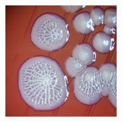 Atypical colonies of E.coli smooth to uneven colonies after prolonged cultivation¨, atypical colonies