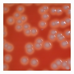 Circular, convex colonies with clear β-hemolysis convex colonies with clear beta-hemolysis