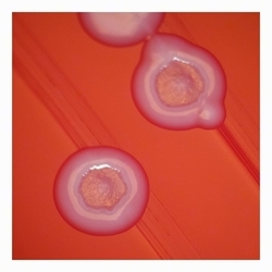 Umbilicate colonies with smooth surface umbilicate colonies