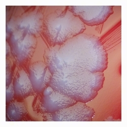 Raised gray colonies with rough surface Raised gray colonies with rough surface