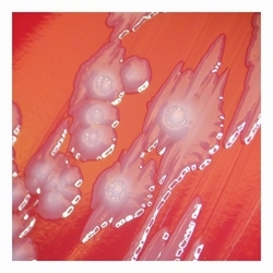 Irregular E. coli colonies irregular colonies with lobate margins