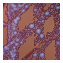 SCVs of Escherichia coli; larger colonies reach ~2 mm E.coli SCVs
