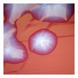 Mucoid colonies (~10 mm) mucoid colonies typical of encapsulated uropathogenic strains of E.coli