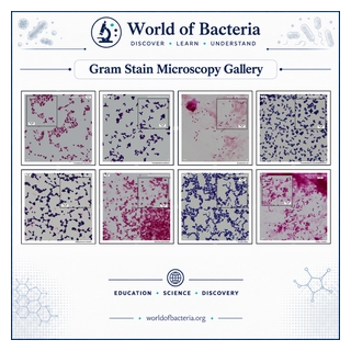 microscopy Gram-stain gallery worldofbacteria.org