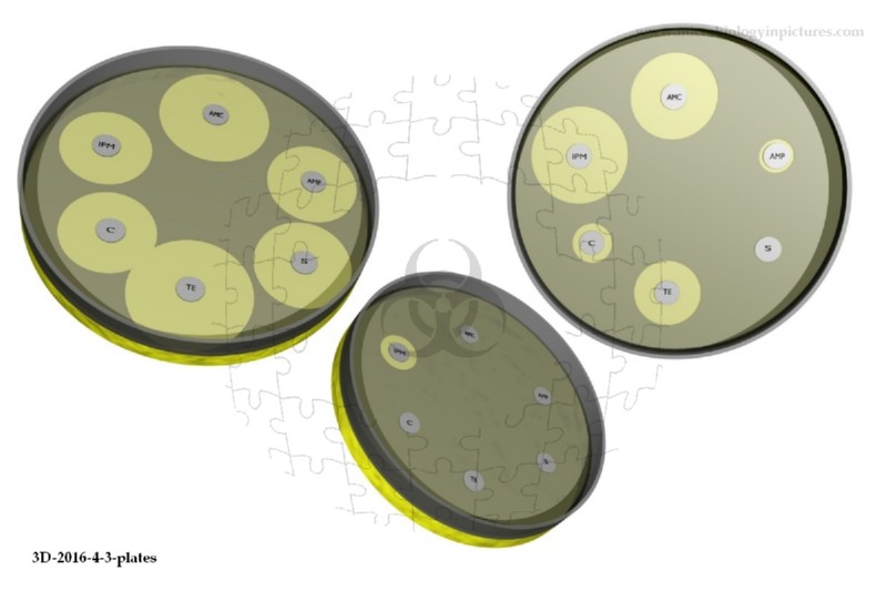 antibiotic susceptibility testing on agar plate