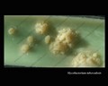 fotografia di un Mycobacterium tuberculosis.di una coltura di Mycobacterium tuberculosis