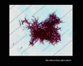 muestra de cultivo de micobacterias teñida a prueba de ácido