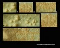 Crecimiento de Mycobacterium tuberculosis en medio Löwenstein-Jensen(L-J)