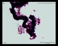 cording in mycobacteria