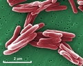 Mycobacterium tuberculosis sem