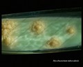 mycobacterium tuberculosis sur L-J