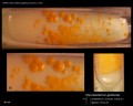 Mycobacterium gordonae