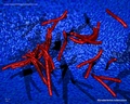 mycobacterium tuberculosis, varillas acidorresistentes